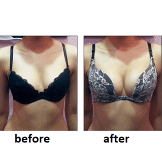 Bust Full Breast Enlargement Cream